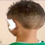 السعودية : حلاق يقطع أذن طفل و السبب عطسة ! صورة الطفل