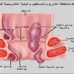 مرض الباسور