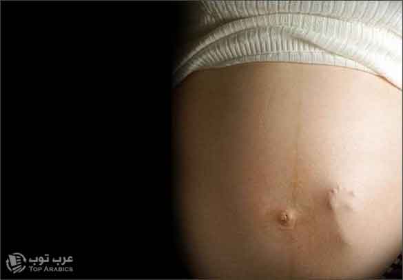 دراسة: الغذاء الصحي خلال فترة الحمل يقلّل تشوهات الأجنة الخلقية المرأة الحامل حامل طفل جنين 